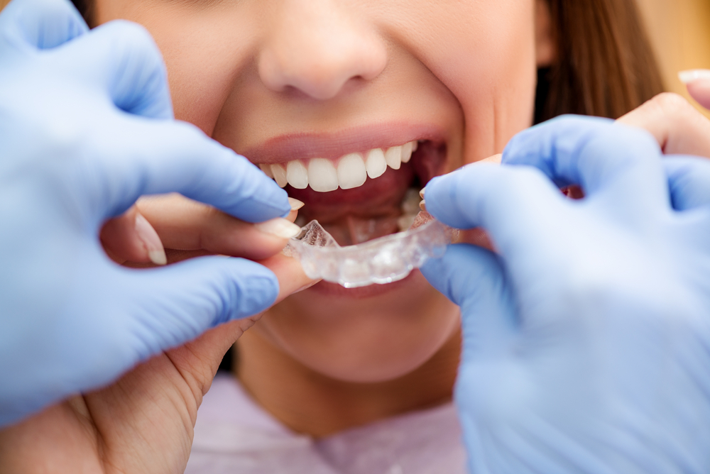 Non-Surgical Dentistry Treatment
