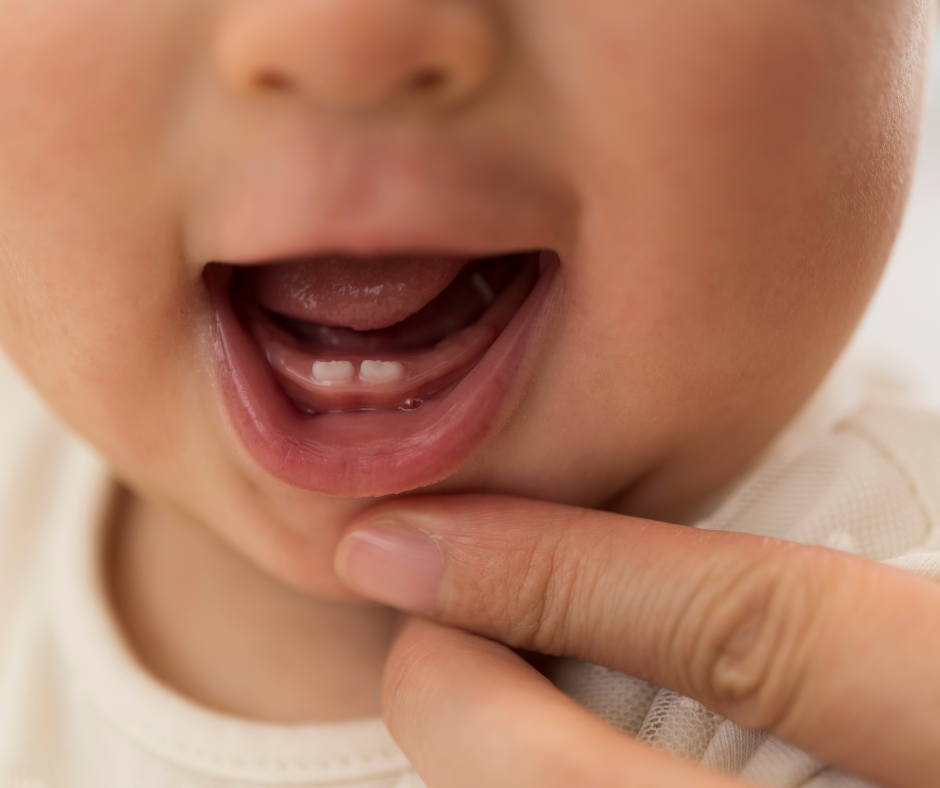Avoid cavities in babies